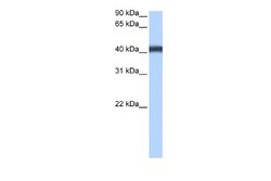 MFSD3 Rabbit anti-Human, Polyclonal, Novus Biologicals 0.1 mL | Buy Online | Novus Biologicals | Fisher Scientific